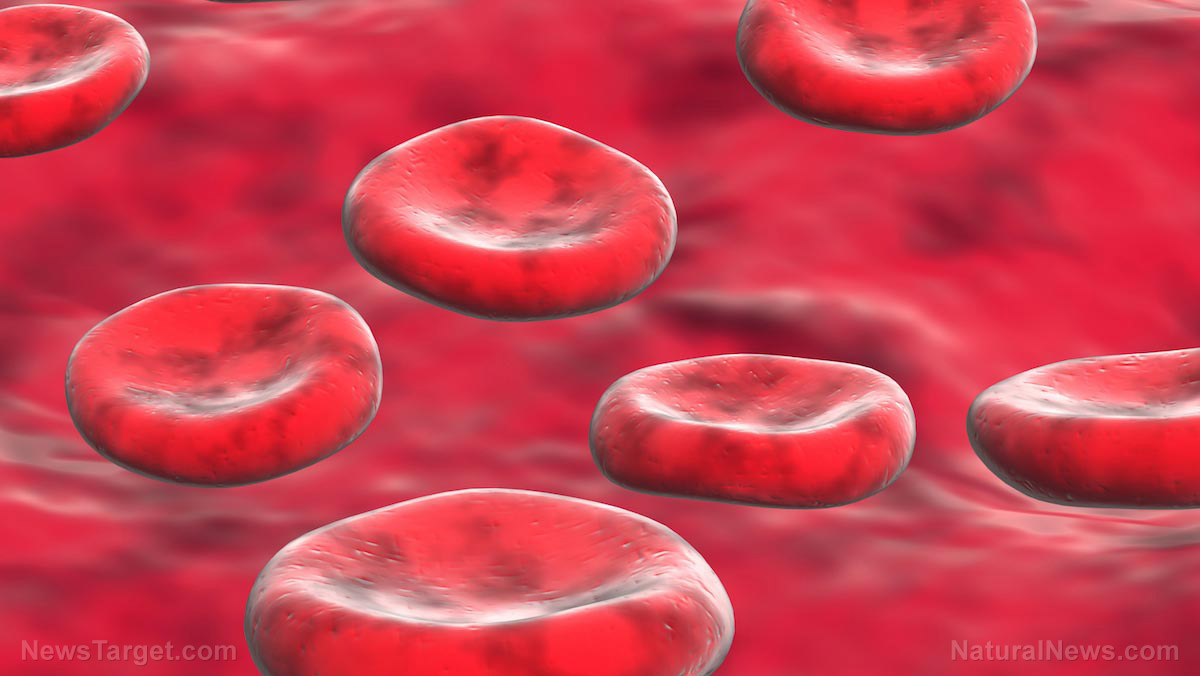 Irondeficiency anemia causes, side effects and